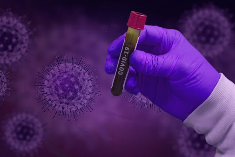 Meghaladta a tízezret az új fertőzöttek száma Oroszországban