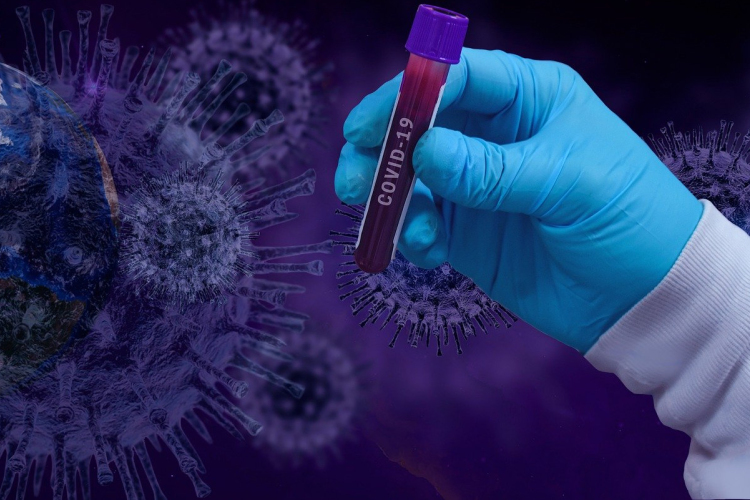 TÁJÉKOZTATÓ COVID-19 MOBIL MINTAVÉTELI LEHETŐSÉGRŐL