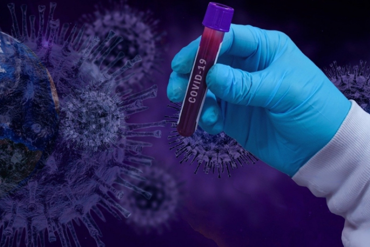 Tájékoztató COVID-19 mobil mintavételi lehetőségről